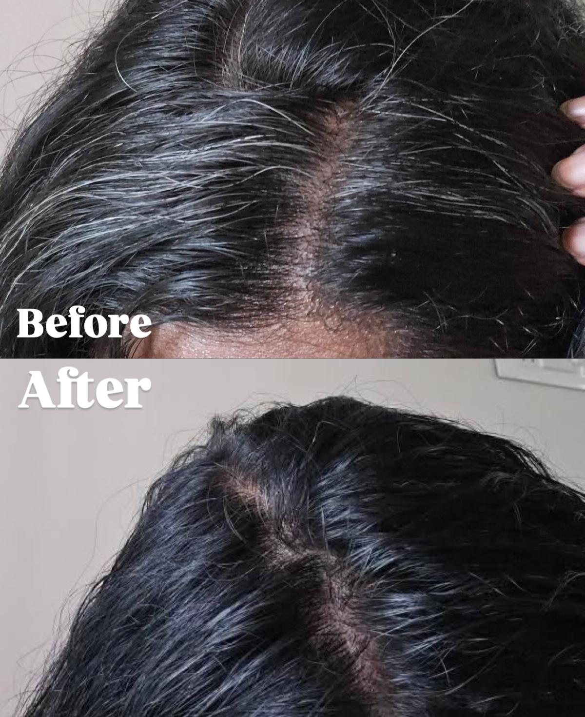 Niram- before after